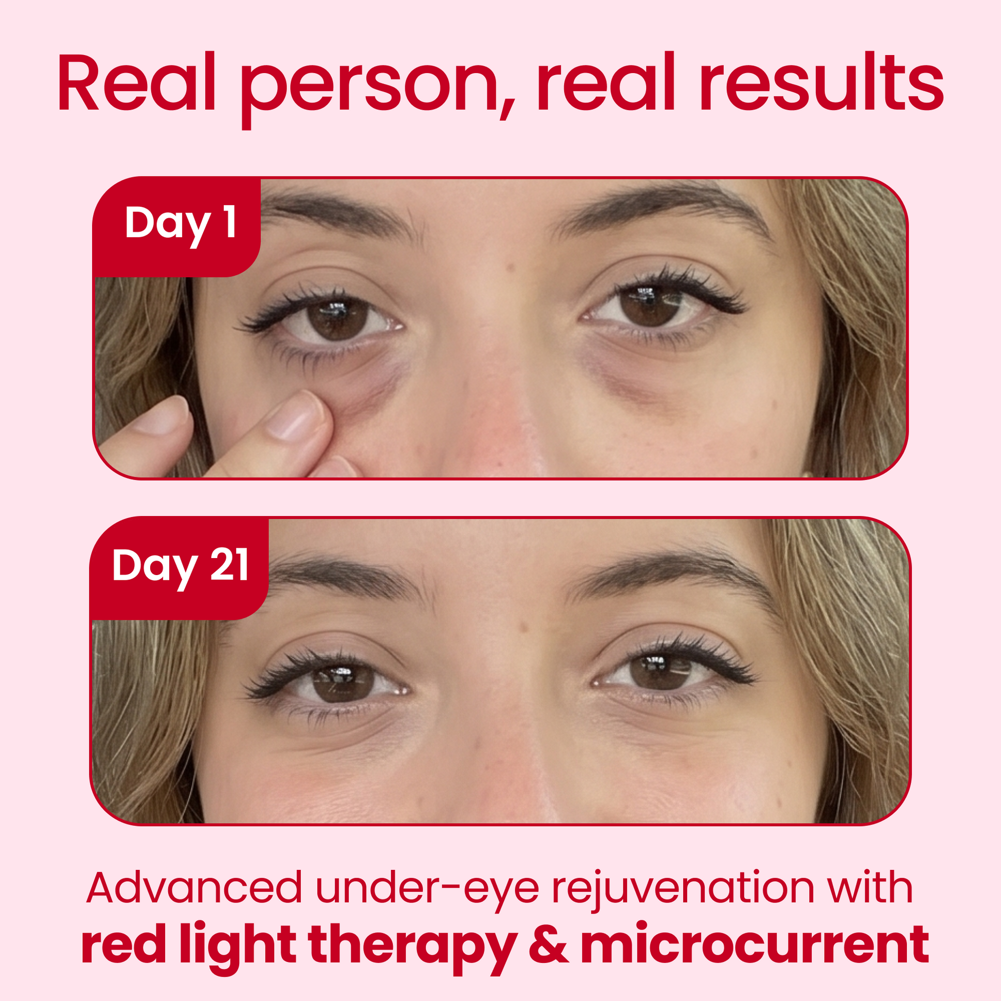 EyeRevive LED Therapy glasses